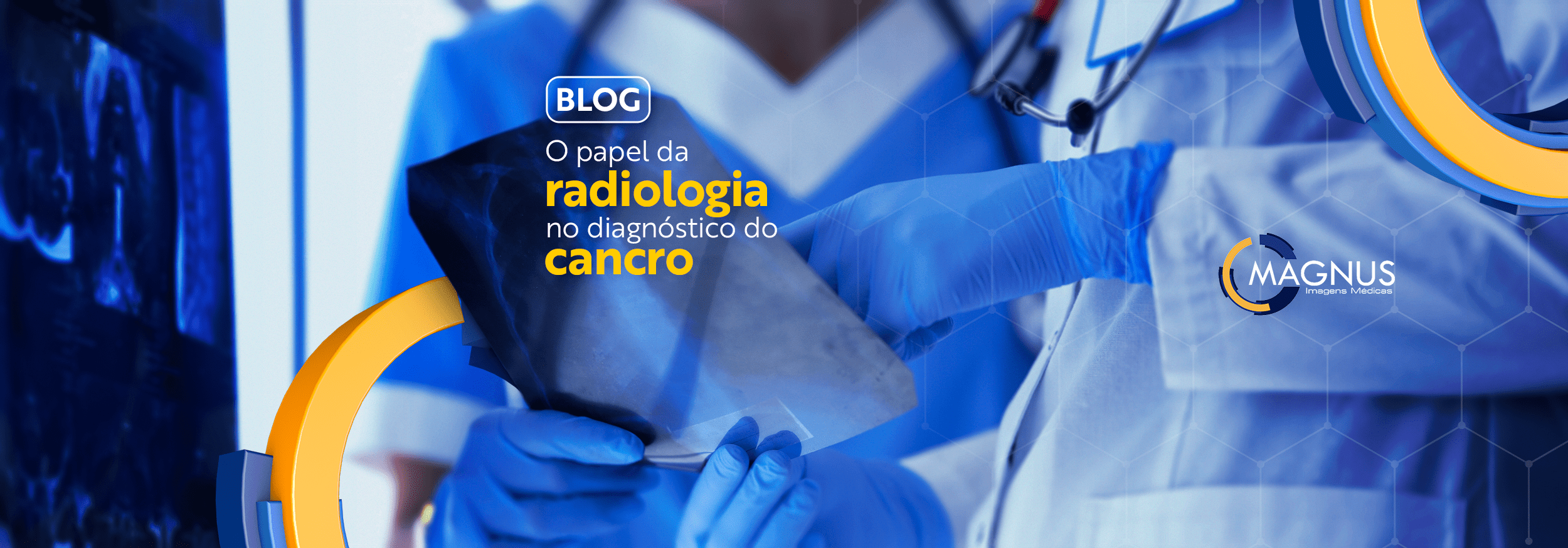 You are currently viewing O papel da radiologia no diagnóstico do cancro