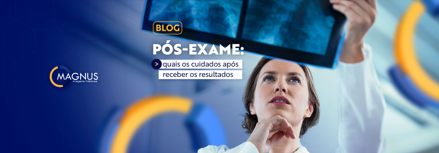 Read more about the article Pós-exame: quais os cuidados após receber o resultado?