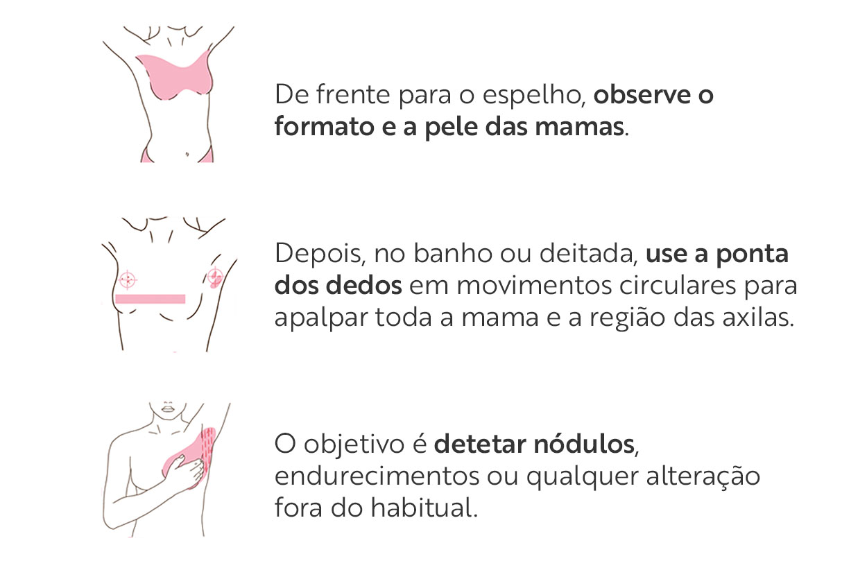 De frente para o espelho, observe o formato e a pele das mamas. Depois, no banho ou deitada, use a ponta dos dedos em movimentos circulares para apalpar toda a mama e a região das axilas. O objetivo é detetar nódulos, endurecimentos ou qualquer alteração fora do habitual.