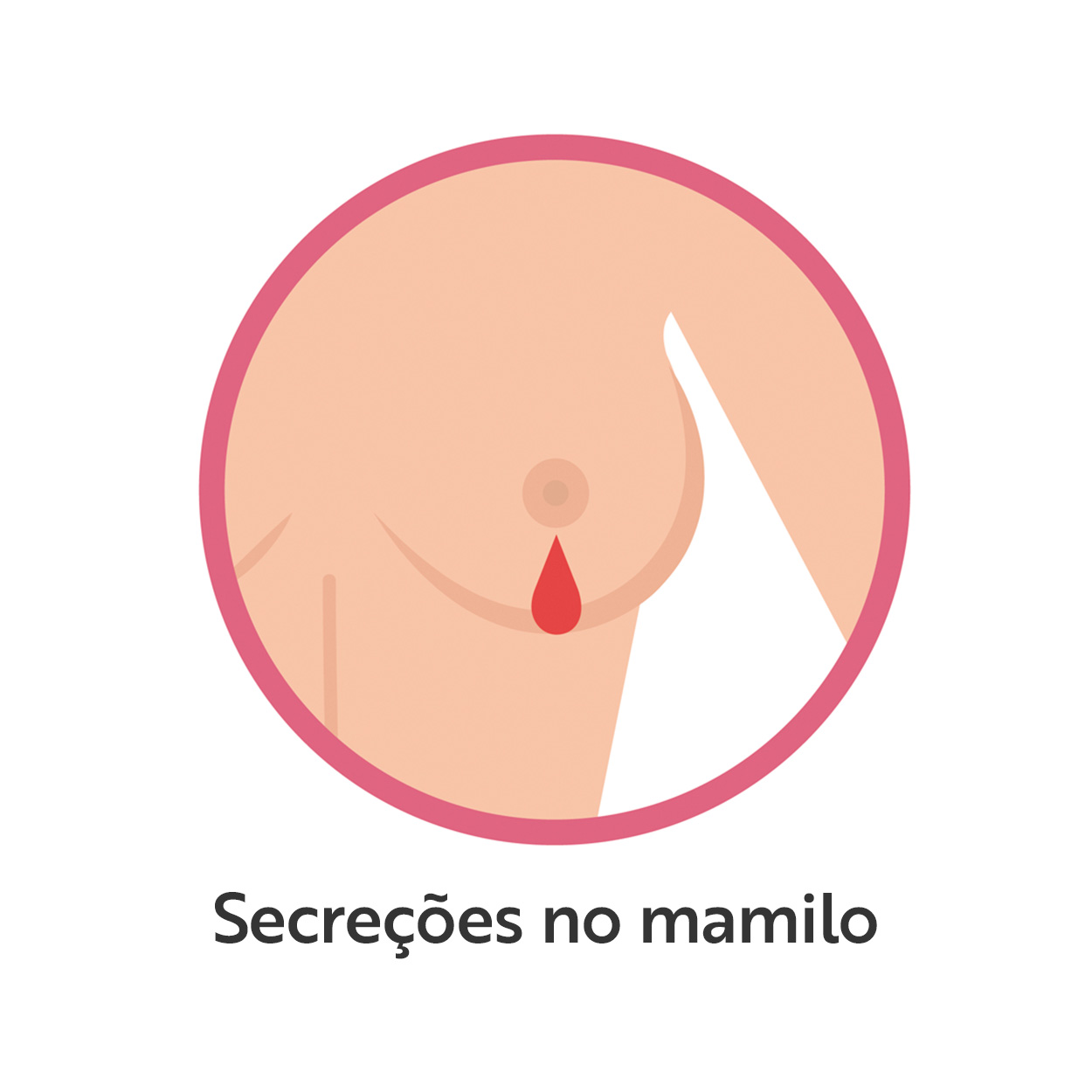 Secreções no mamilo