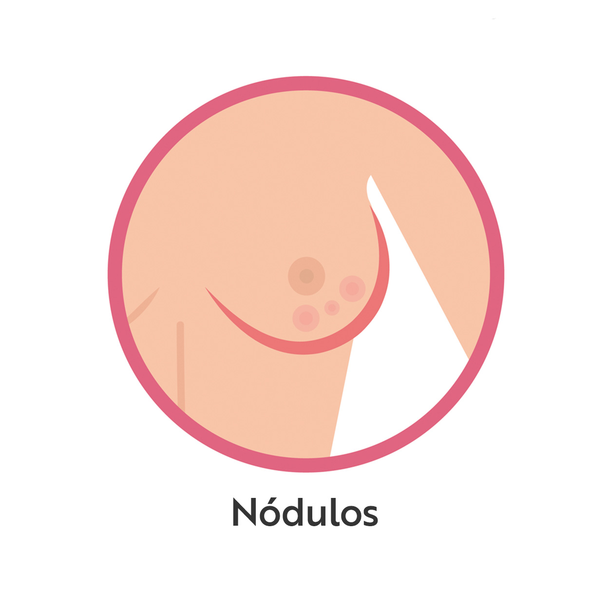 Nódulos