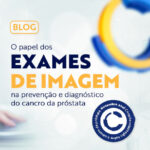 O papel dos exames de imagem na prevenção e diagnóstico do cancro de próstata