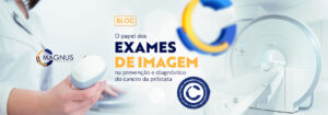 Read more about the article O papel dos exames de imagem na prevenção e diagnóstico do cancro de próstata