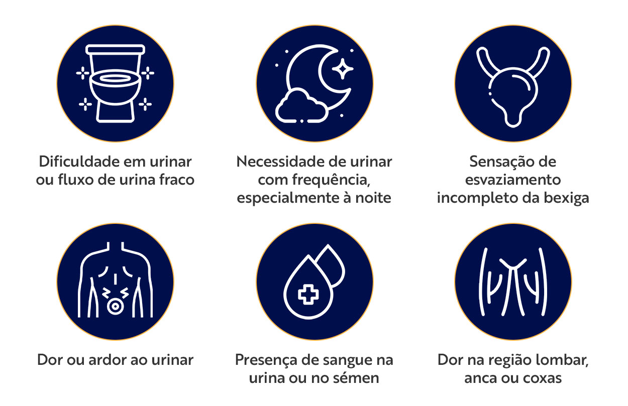 Sinais e sintomas do cancro da próstata Dificuldade em urinar ou fluxo de urina fraco Necessidade de urinar com frequência, especialmente à noite Sensação de esvaziamento incompleto da bexiga Dor ou ardor ao urinar Presença de sangue na urina ou no sémen Dor na região lombar, anca ou coxas