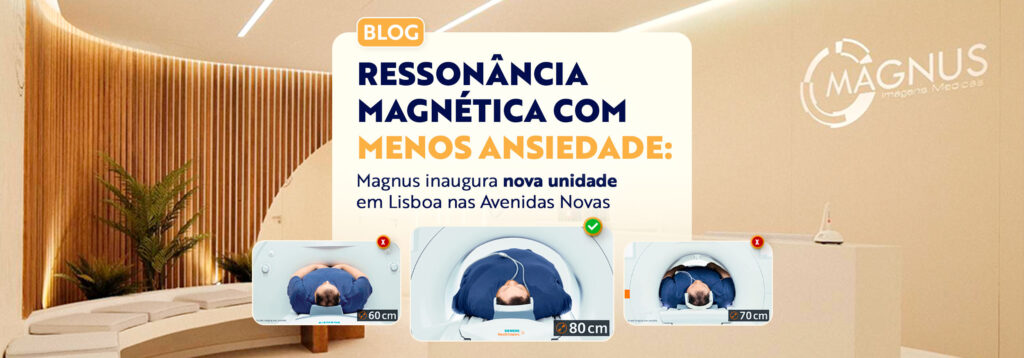 MAGNETOM Free.Max
