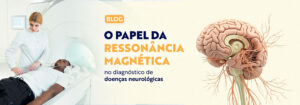 Read more about the article Ressonância Magnética e as Doenças Neurológicas: Como Pode Transformar um Diagnóstico