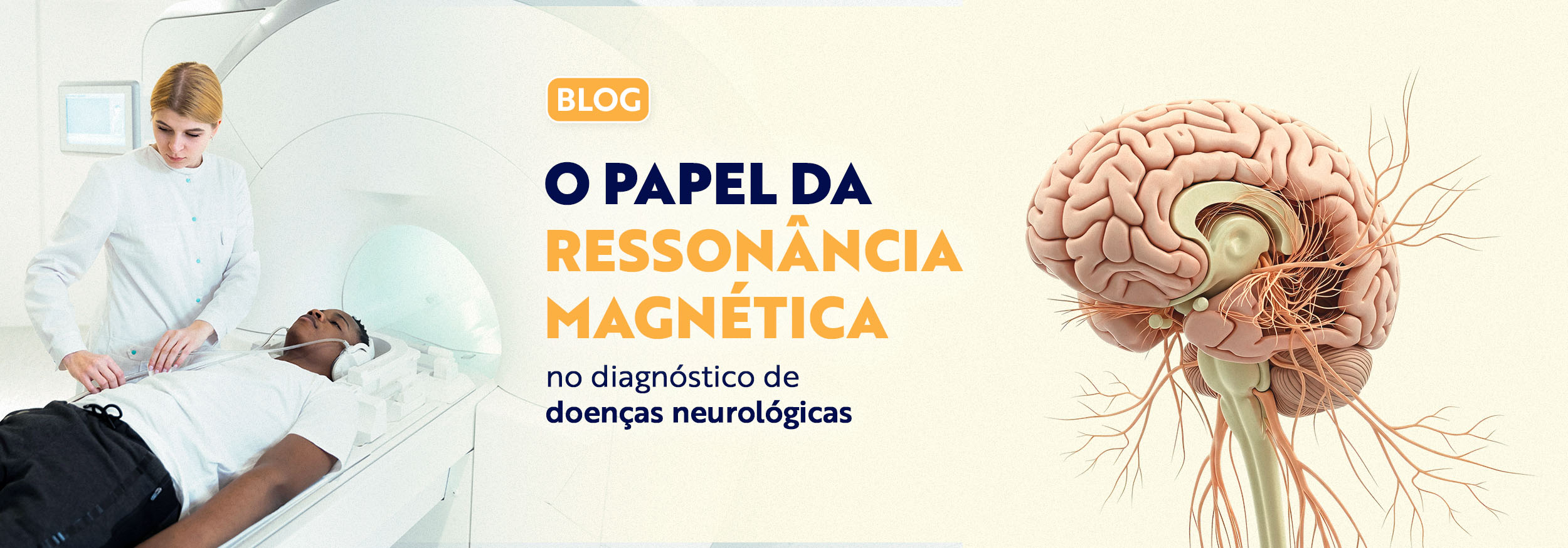 Read more about the article Ressonância Magnética e as Doenças Neurológicas: Como Pode Transformar um Diagnóstico