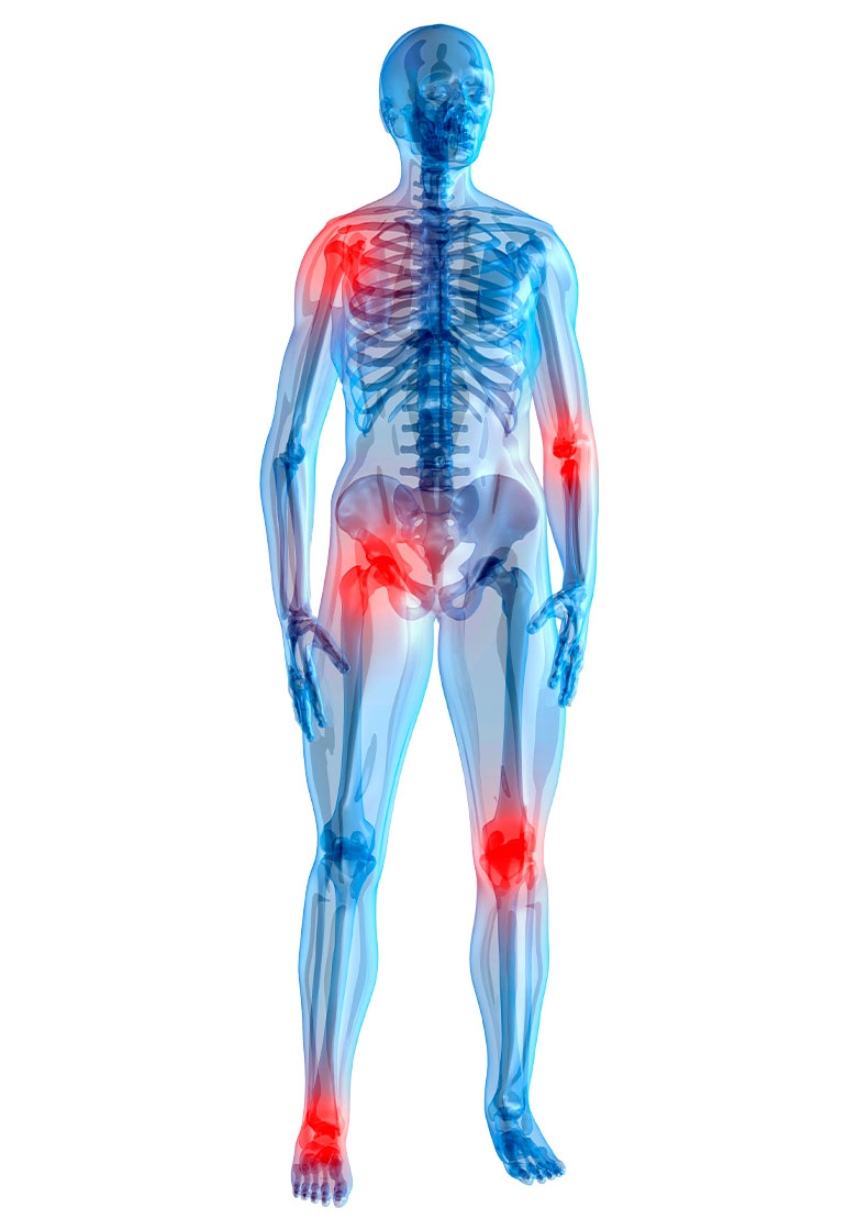 Doenças Osteoarticulares 